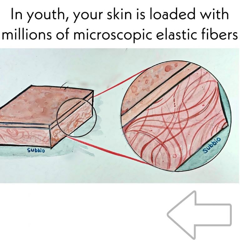 Diagram of Skin
