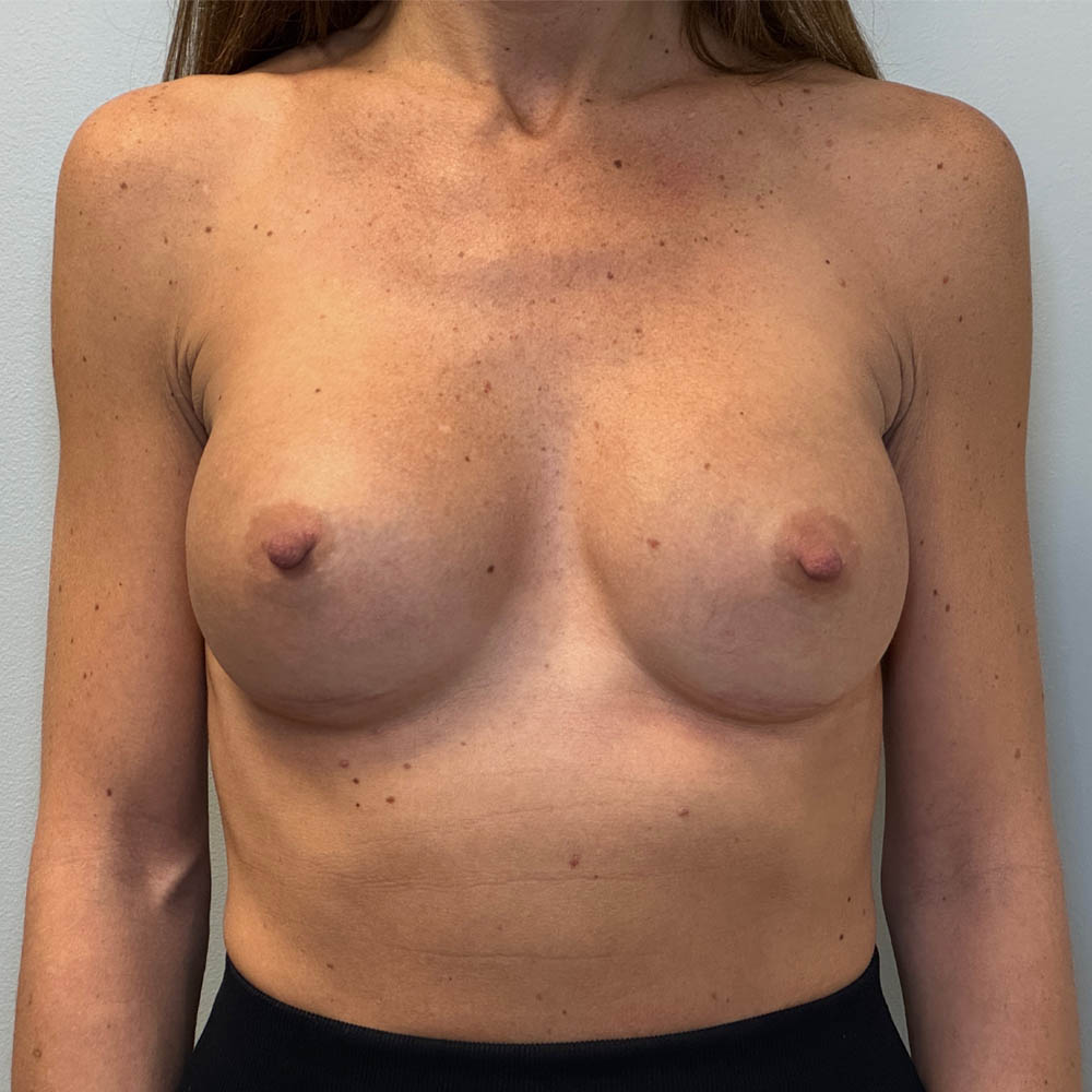 1_0021_Photo Aug 14 2025, 12 51 53 PM (4).jpg